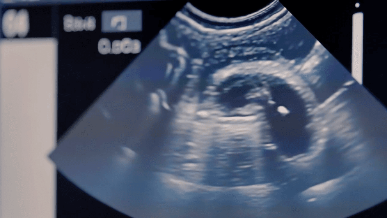 AI Video Generator for Explainer Videos